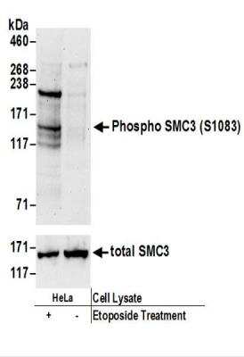 Western Blot: SMC3 [p Ser103] Antibody [NBP2-37694]